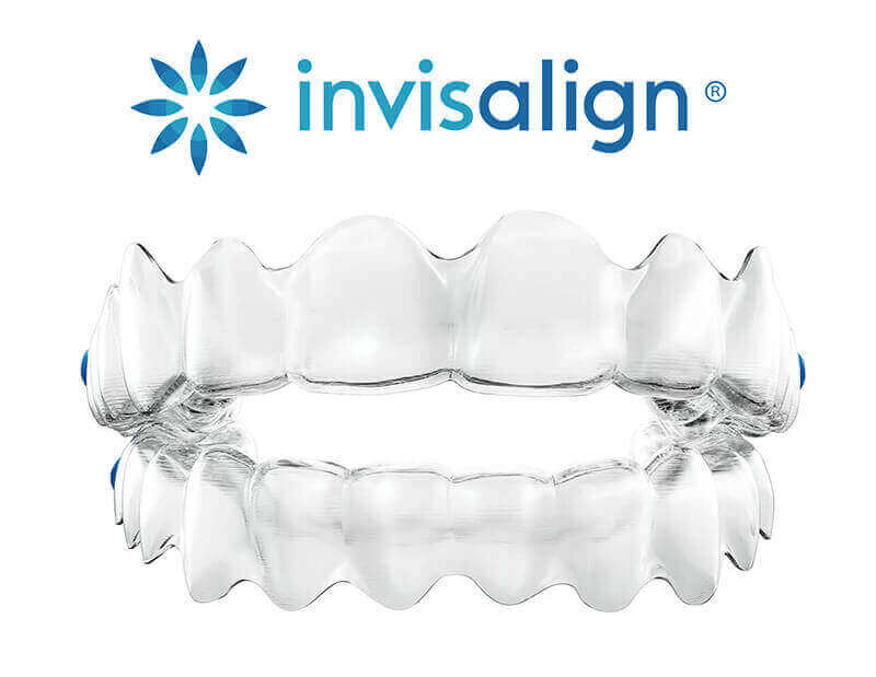 INVISALIGN