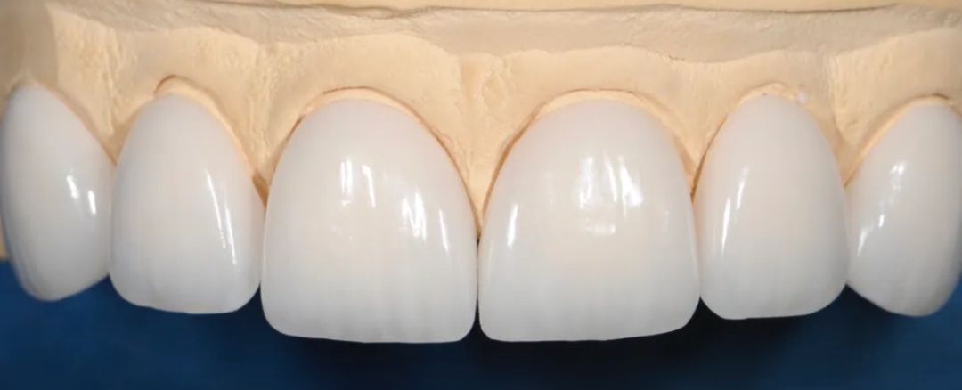 Dentisterie Esthétique